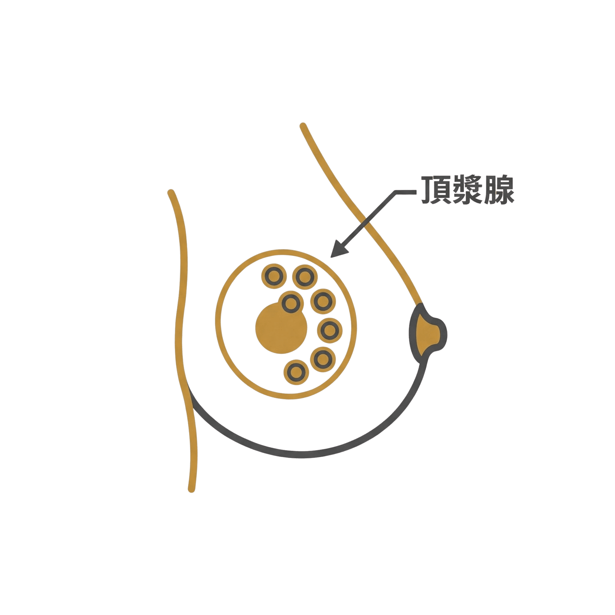 0.3cm 극한 최소절개